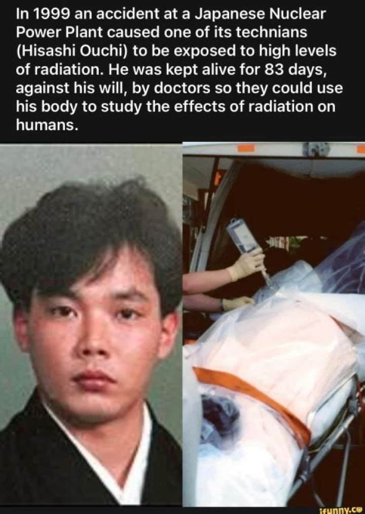 Disturbing Images Of Hisashi Ouchi