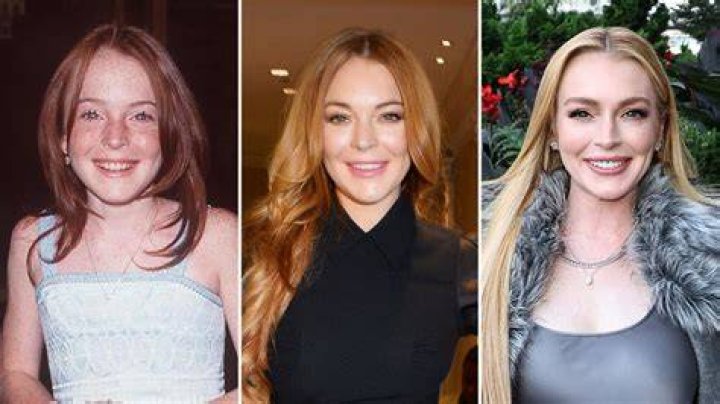 Lindsay Lohan's Journey With Plastic Surgery