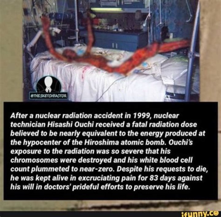 The Horrific Case Of Hisashi Ouchi: A Nuclear Nightmare