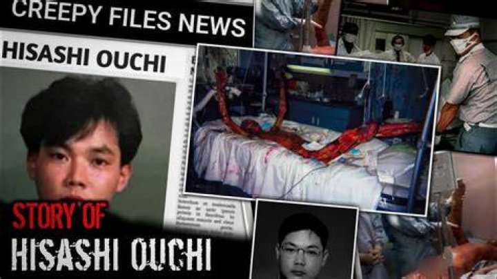 The Tragic Tale Of Hisashi Ouchi: Japan's Longest-Suffering Nuclear Victim
