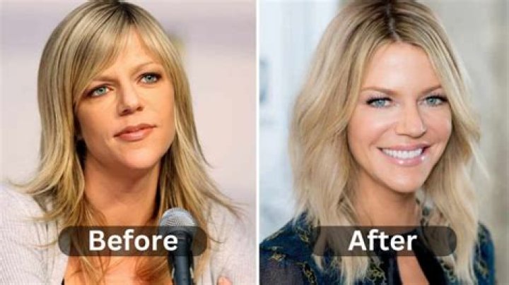 The Ultimate Guide To Kaitlin Olson's Plastic Surgery Procedures