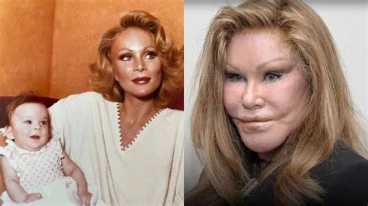 The Unbelievable Story Of Jocelyn Wildenstein: From Beauty To Controversy