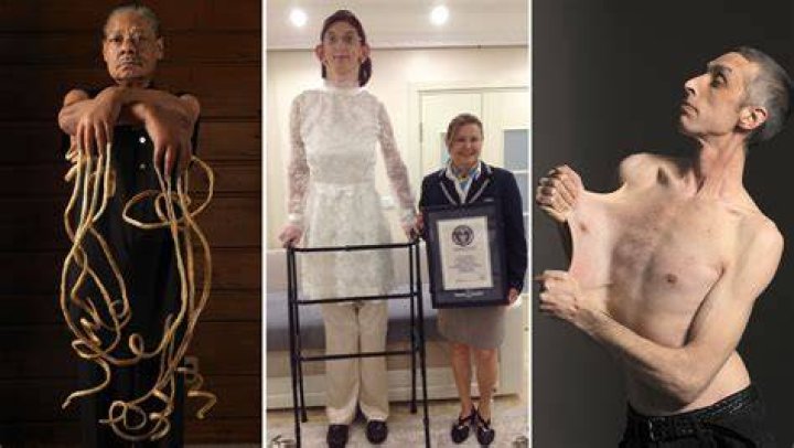 The World's Skinniest Woman: A Remarkable Journey