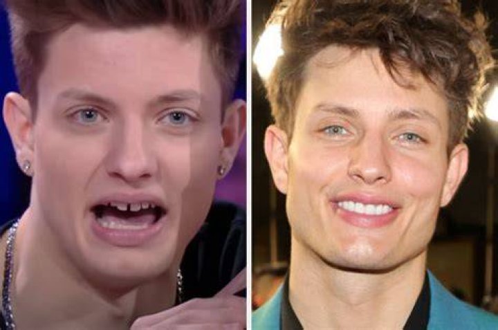 Unlocking The Secrets Of Matt Rife's Captivating Smile