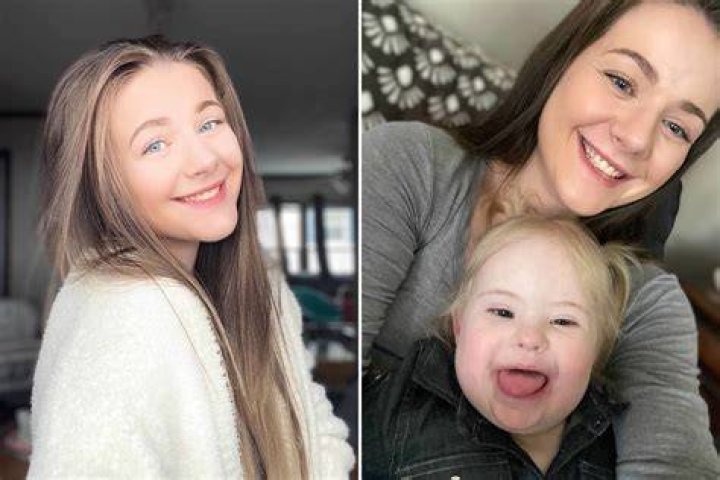 Unraveling The Mystery Of Down Syndrome