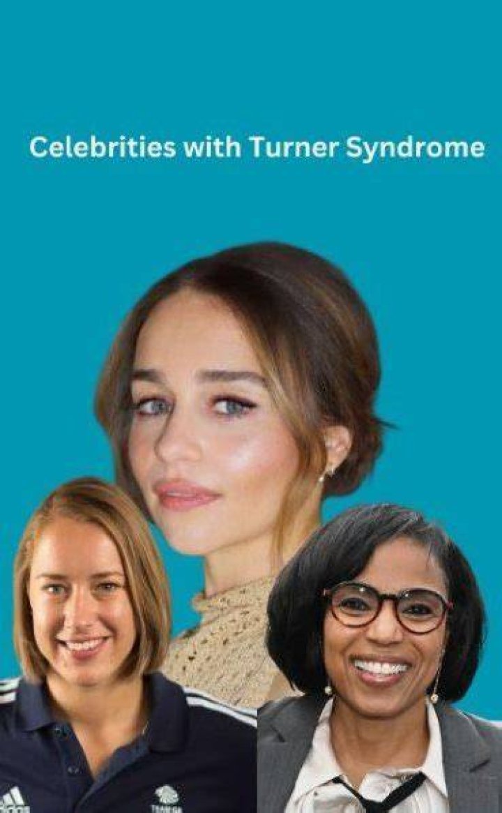 Unveiling The Remarkable Journeys Of Famous People With Turner Syndrome