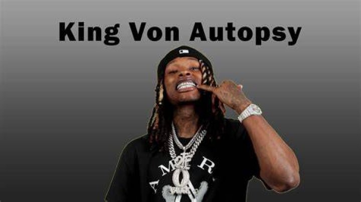 WARNING: Graphic Content - Autopsy Images Released Of King Von